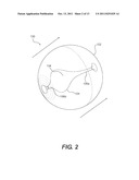 EXERCISE DEVICE WITH SUSPENDED INERTIAL CORE diagram and image