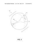 EXERCISE DEVICE WITH SUSPENDED INERTIAL CORE diagram and image