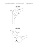 EXERCISE APPARATUS AND METHOD THEREFOR diagram and image