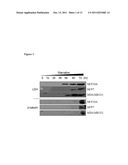 BIOMARKERS FOR BREAST CANCER diagram and image