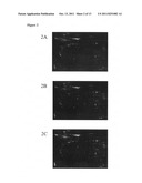 BIOMARKERS FOR BREAST CANCER diagram and image