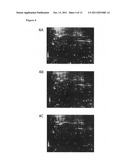 BIOMARKERS FOR BREAST CANCER diagram and image