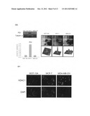 BIOMARKERS FOR BREAST CANCER diagram and image