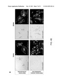 THYMOSIN Beta4 PEPTIDES PROMOTE TISSUE REGENERATION diagram and image