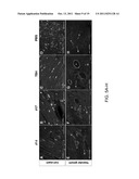 THYMOSIN Beta4 PEPTIDES PROMOTE TISSUE REGENERATION diagram and image