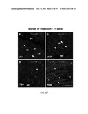 THYMOSIN Beta4 PEPTIDES PROMOTE TISSUE REGENERATION diagram and image