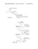 GLUE COMPOSITION FOR LUNG VOLUME REDUCTION diagram and image