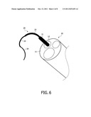 NESTED CANNULA CONFIGURATION FOR USE WITH ENDOSCOPE diagram and image