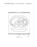 Anatomical visualization and measurement system diagram and image