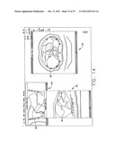 Anatomical visualization and measurement system diagram and image