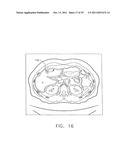 Anatomical visualization and measurement system diagram and image