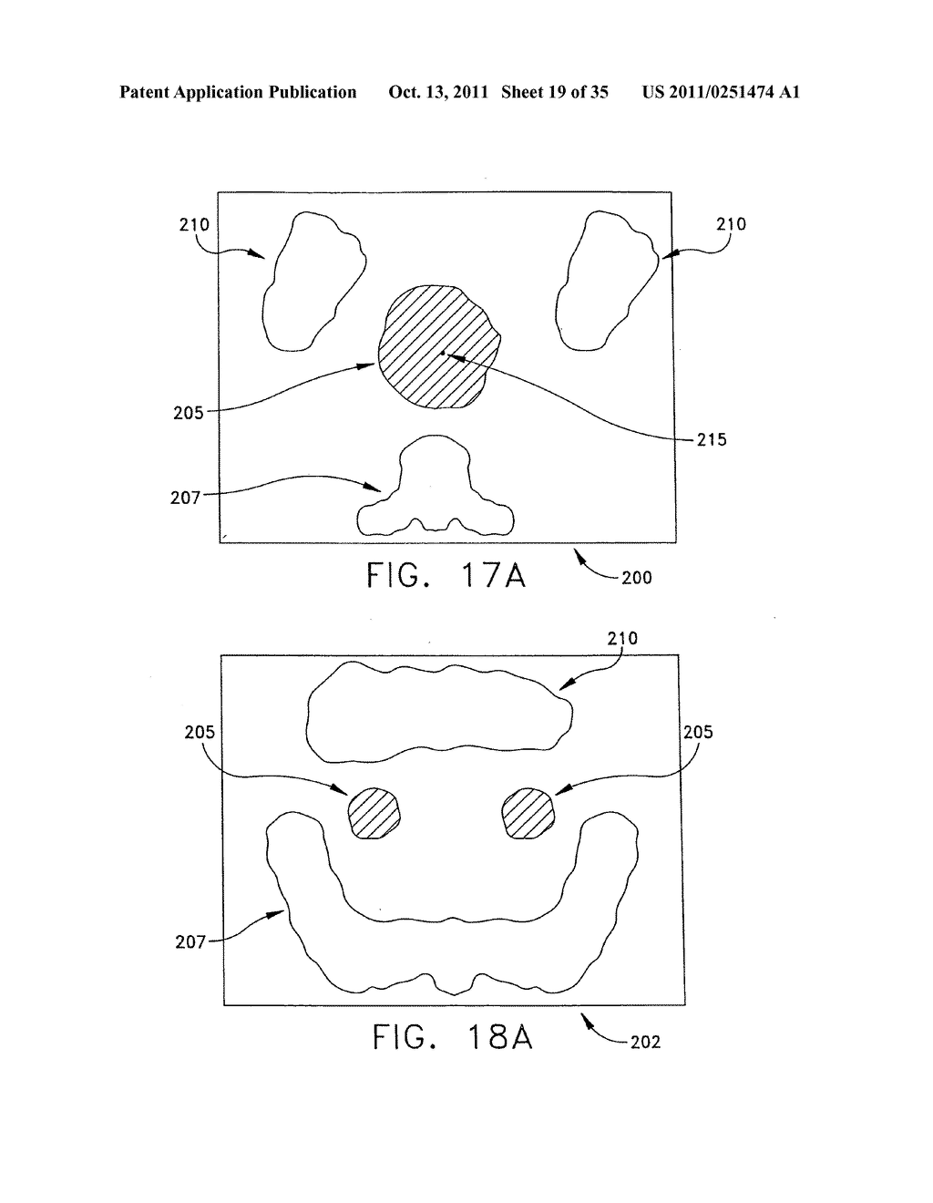 Anatomical visualization and measurement system - diagram, schematic, and image 20