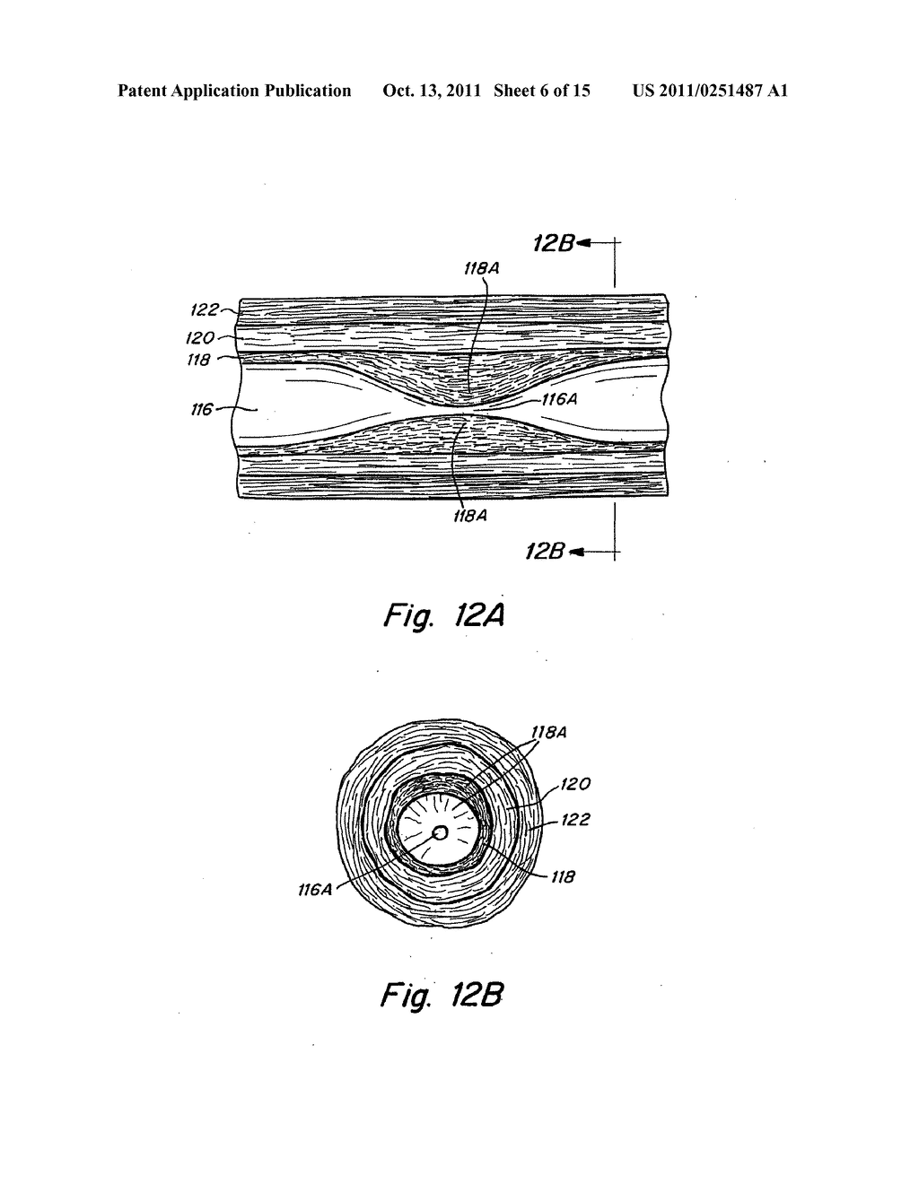 Apparatus and Methods for Intravascular Ultrasound Imaging and for     Crossing Severe Vascular Occlusions - diagram, schematic, and image 07