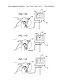 ULTRASOUND MONITORING SYSTEMS, METHODS AND COMPONENTS diagram and image