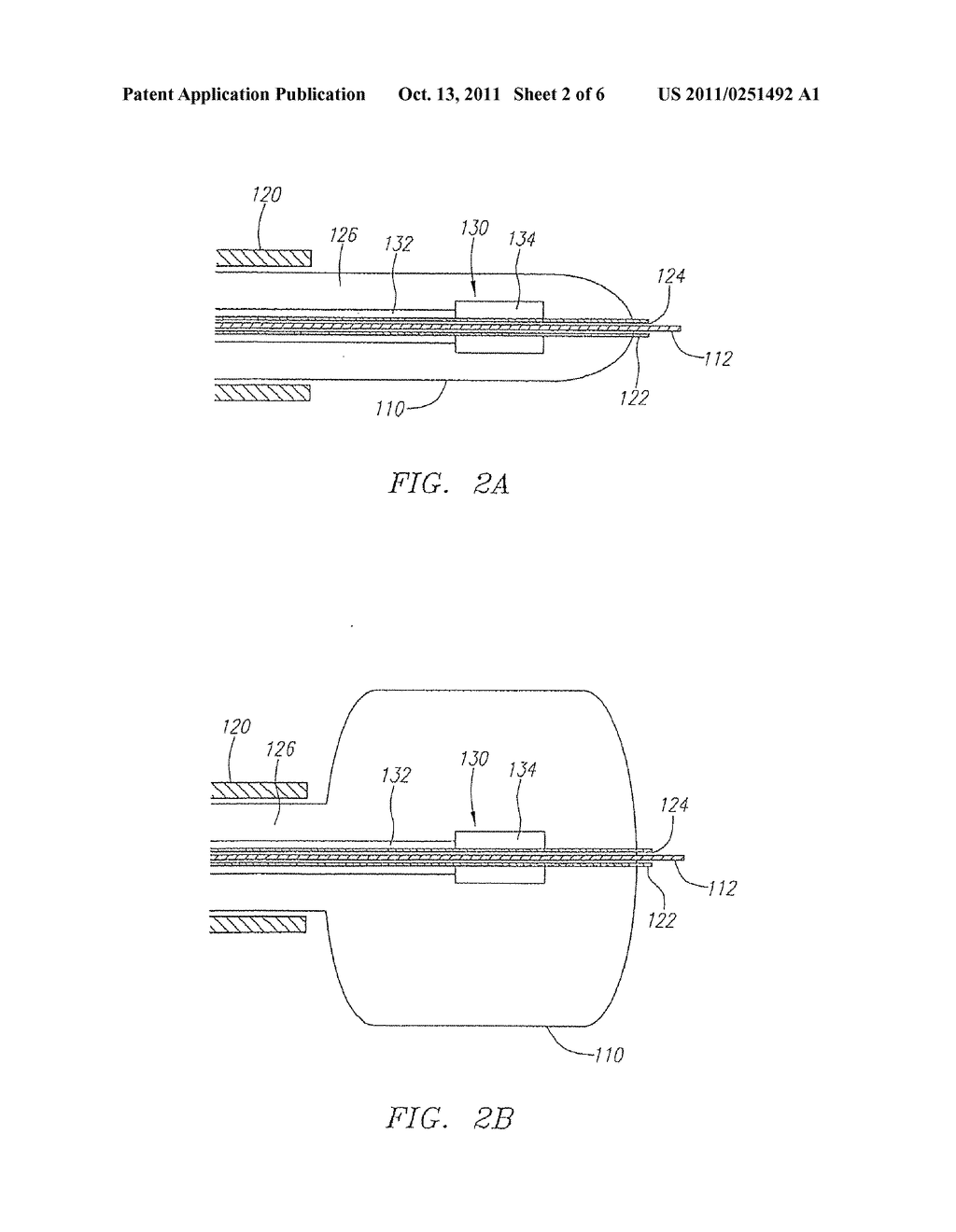 ULTRASOUND ASSESSMENT OF LUMENS TO FACILITATE REPAIR OR REPLACEMENT - diagram, schematic, and image 03