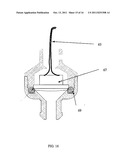 NOISE REJECTING ELECTRONIC STETHOSCOPE diagram and image