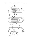 VARIABLE STIFFNESS STEERING MECHANISM FOR CATHETERS diagram and image