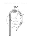 VARIABLE STIFFNESS STEERING MECHANISM FOR CATHETERS diagram and image