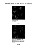 TRANSFECTION WITH MAGNETIC NANOPARTICLES AND ULTRASOUND diagram and image