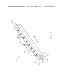 Catheter with Variable Attachment Means diagram and image