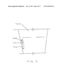 Catheter with Variable Attachment Means diagram and image