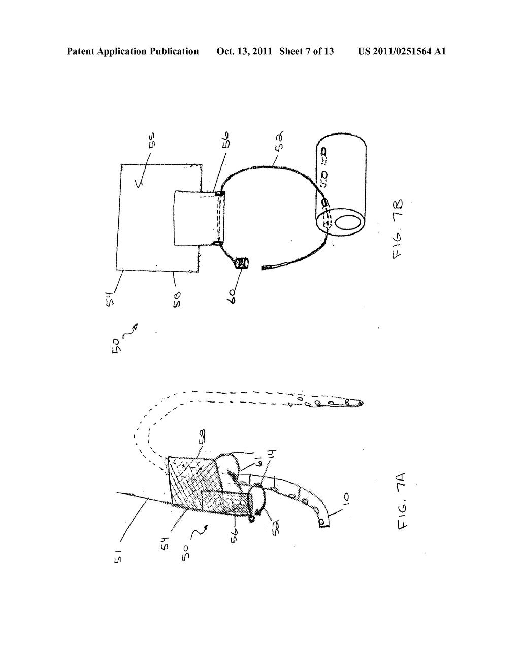 Catheter with Variable Attachment Means - diagram, schematic, and image 08