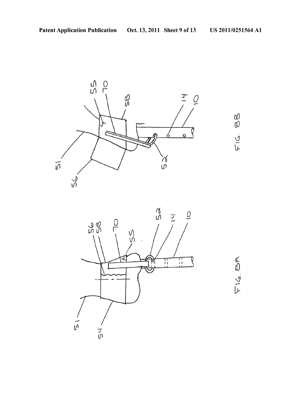 Catheter with Variable Attachment Means - diagram, schematic, and image 10