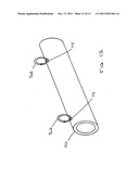 Catheter with Variable Attachment Means diagram and image