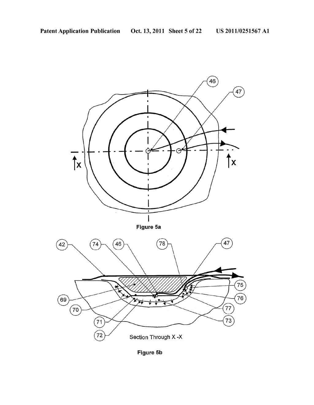 APPARATUS FOR ASPIRATING, IRRIGATING AND CLEANSING WOUNDS - diagram, schematic, and image 06