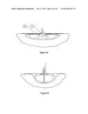 APPARATUS FOR ASPIRATING, IRRIGATING AND CLEANSING WOUNDS diagram and image