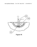 APPARATUS FOR ASPIRATING, IRRIGATING AND CLEANSING WOUNDS diagram and image