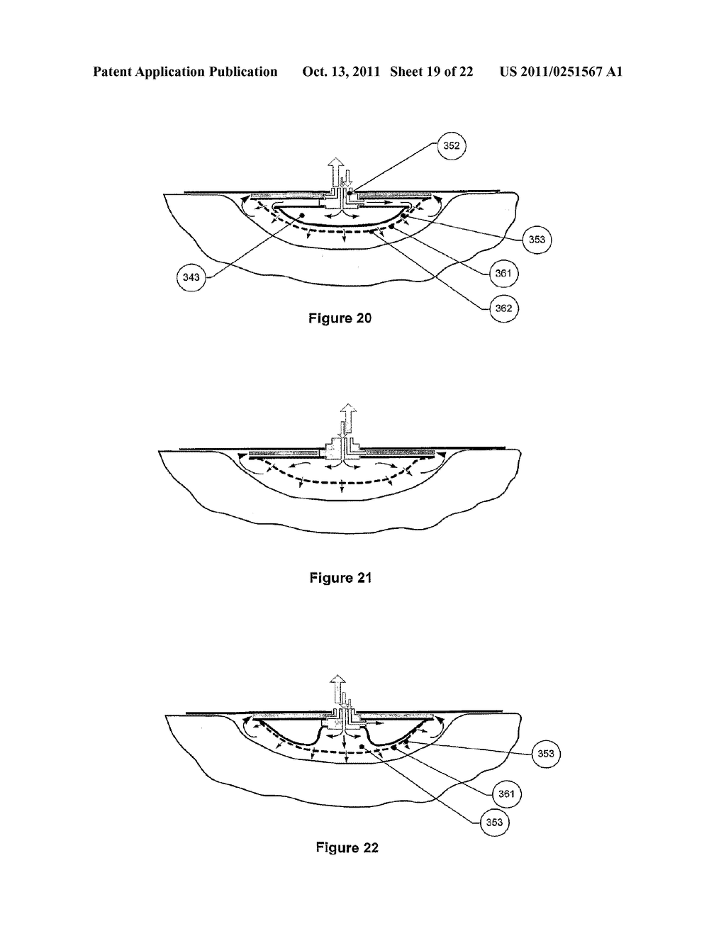 APPARATUS FOR ASPIRATING, IRRIGATING AND CLEANSING WOUNDS - diagram, schematic, and image 20