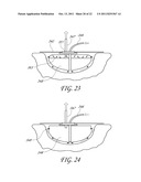 APPARATUS FOR ASPIRATING, IRRIGATING AND CLEANSING WOUNDS diagram and image