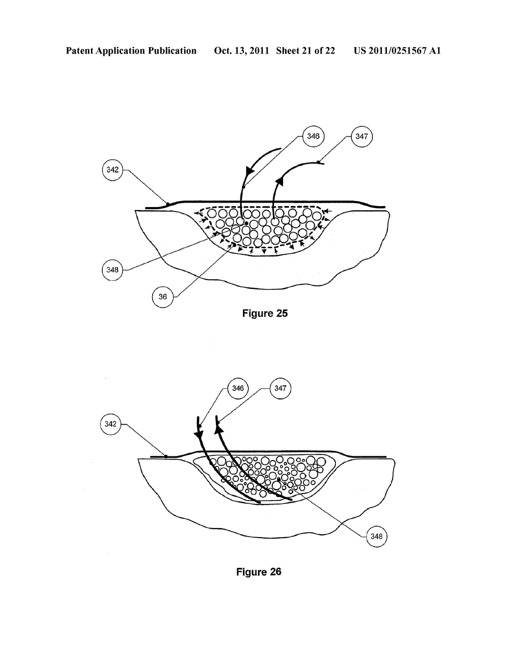 APPARATUS FOR ASPIRATING, IRRIGATING AND CLEANSING WOUNDS - diagram, schematic, and image 22