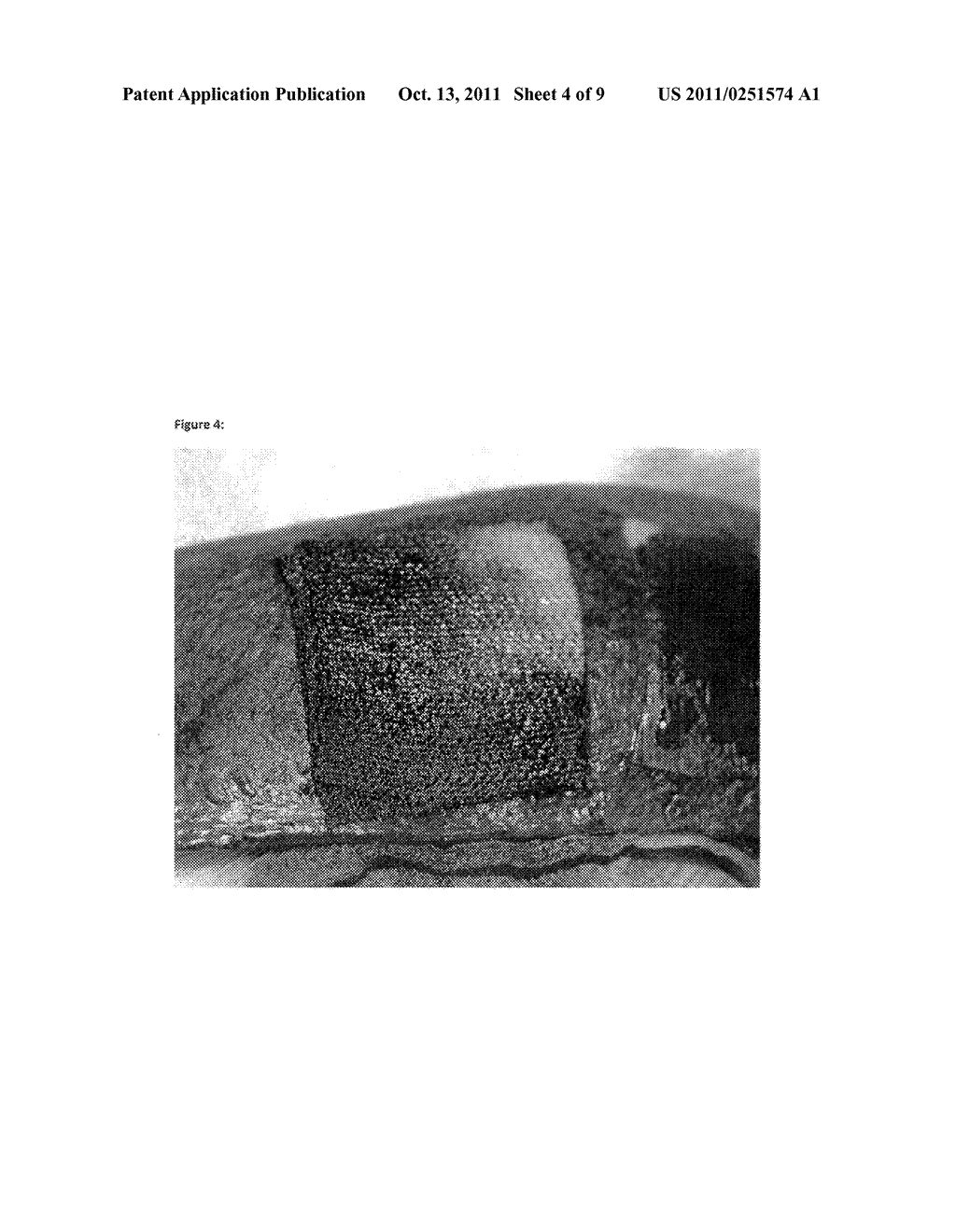 HEMOSTATIC SPONGE - diagram, schematic, and image 05