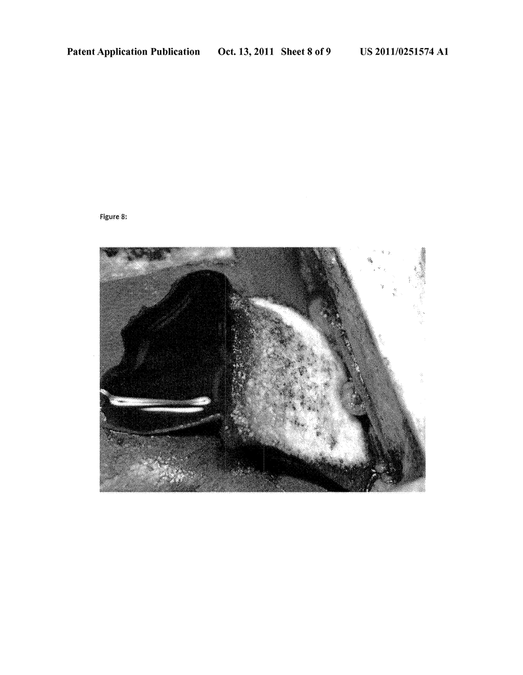 HEMOSTATIC SPONGE - diagram, schematic, and image 09