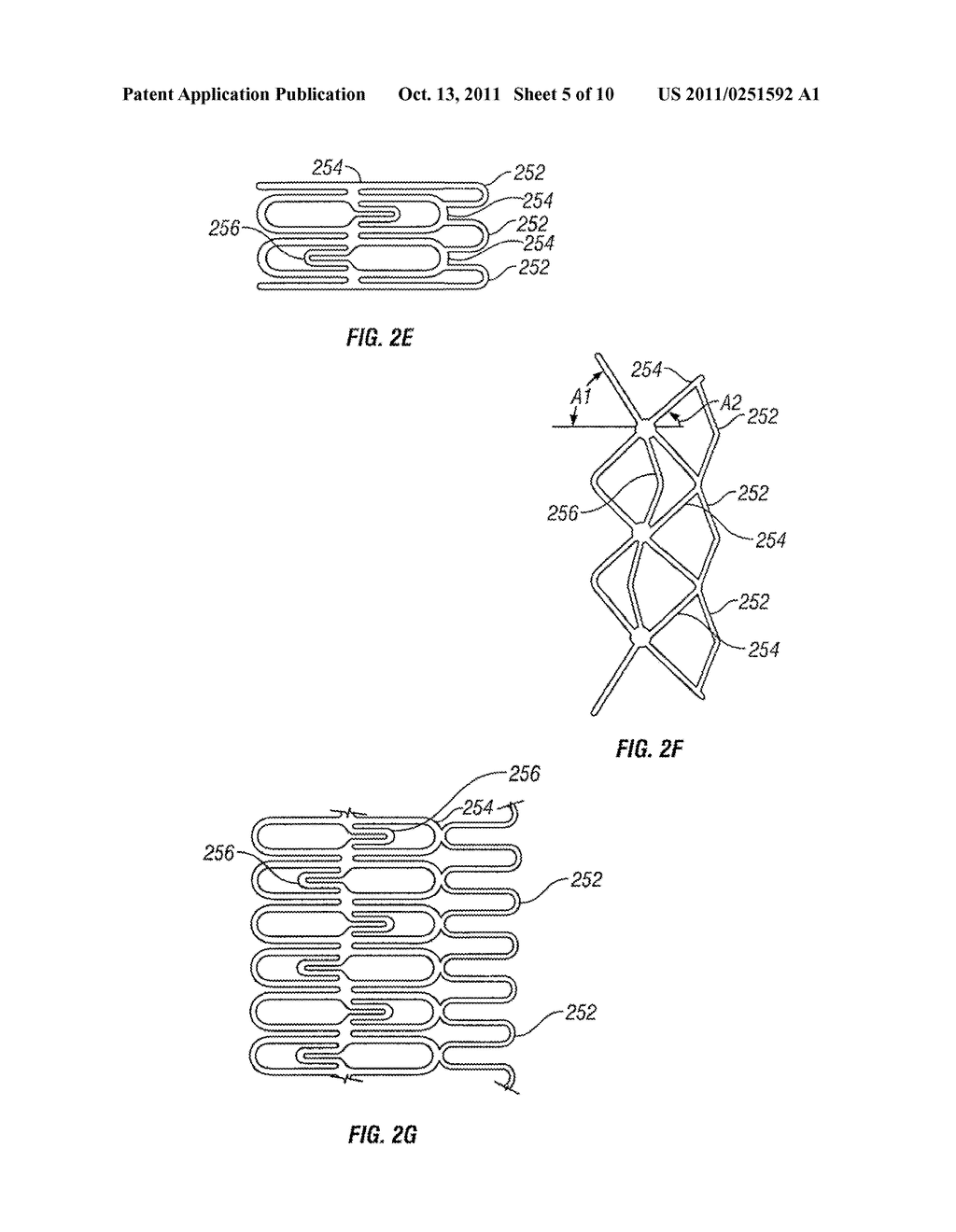 DEVICES FOR MAINTAINING SURGICALLY CREATED OPENINGS - diagram, schematic, and image 06