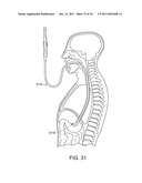 CABLE ACTUATED END-EFFECTOR FOR A SURGICAL INSTRUMENT diagram and image