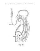 ELECTROSURGICAL CUTTING AND SEALING INSTRUMENTS WITH CAM-ACTUATED JAWS diagram and image