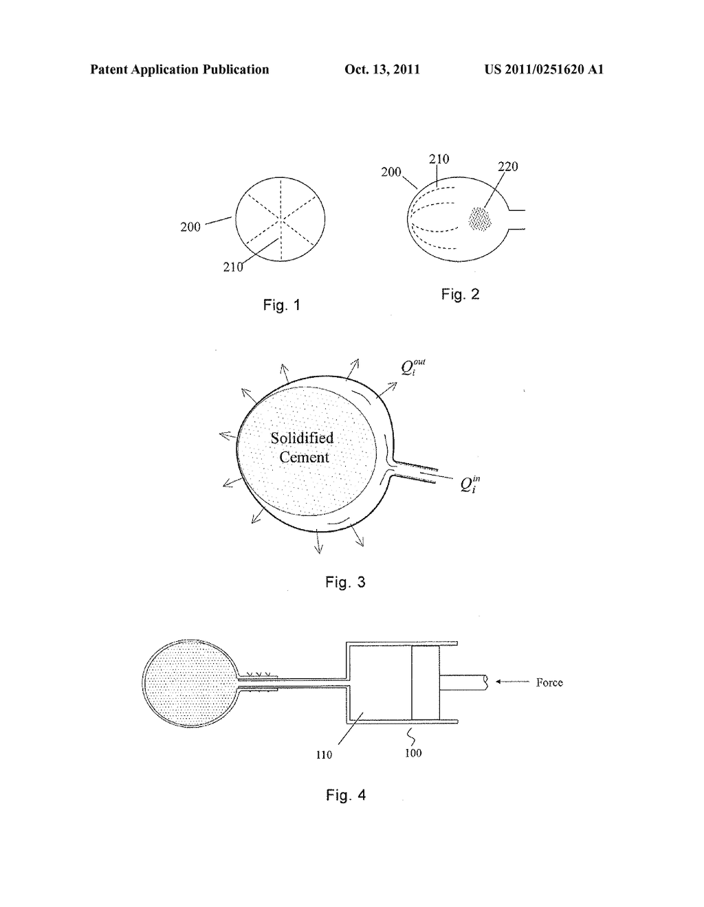 PERFORATED BALLOON AND METHOD FOR FORMING A HARDENED ORTHOPAEDIC PASTE IN     A BONE USING SAME - diagram, schematic, and image 02