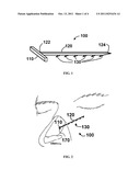 APPARATUS AND METHODS FOR CORRECTING NASAL VALVE COLLAPSE diagram and image