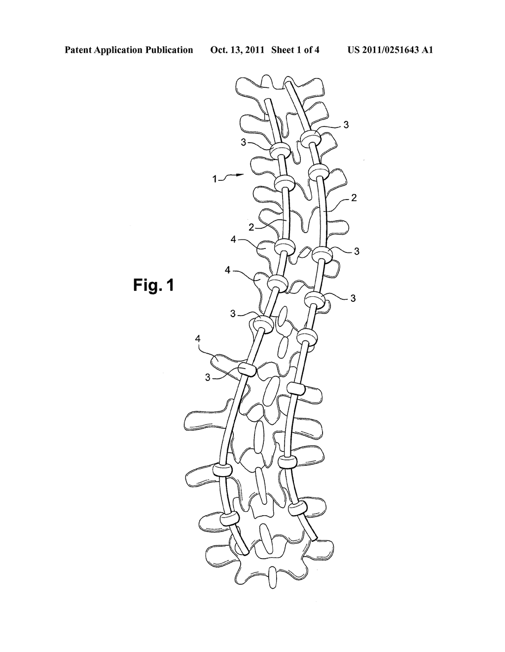 Spinal Osteosynthesis System - diagram, schematic, and image 02