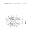 DYNAMIC STABILIZATION SYSTEM USING POLYAXIAL SCREWS diagram and image