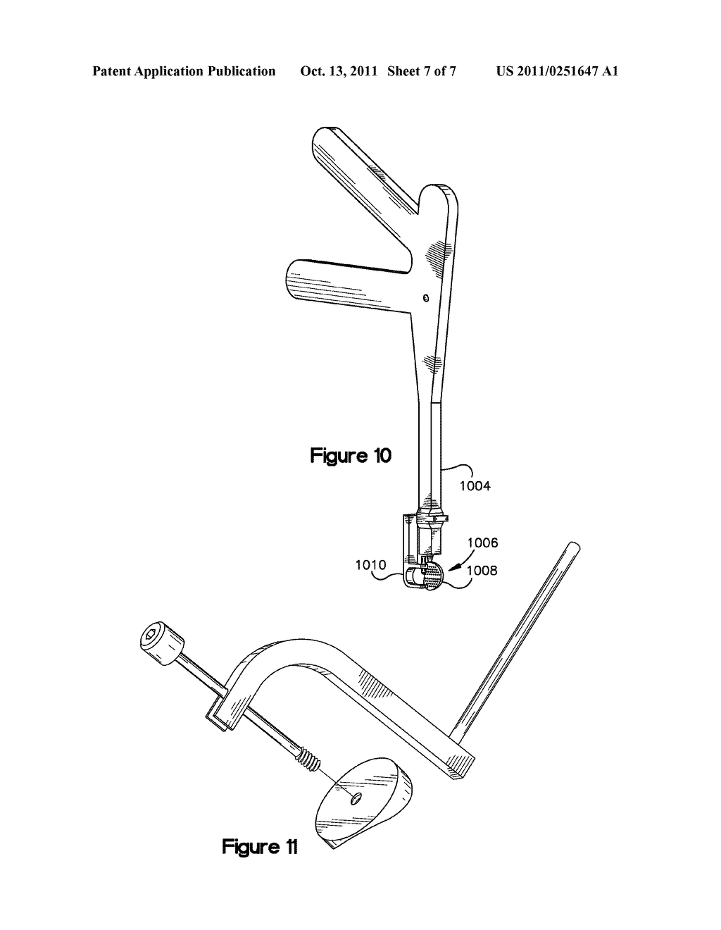 METHOD FOR RESURFACING A LUMBAR ARTICULAR FACET - diagram, schematic, and image 08