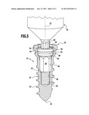 BONE SCREW diagram and image