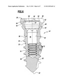 BONE SCREW diagram and image