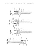 BONE ANCHORING DEVICE diagram and image