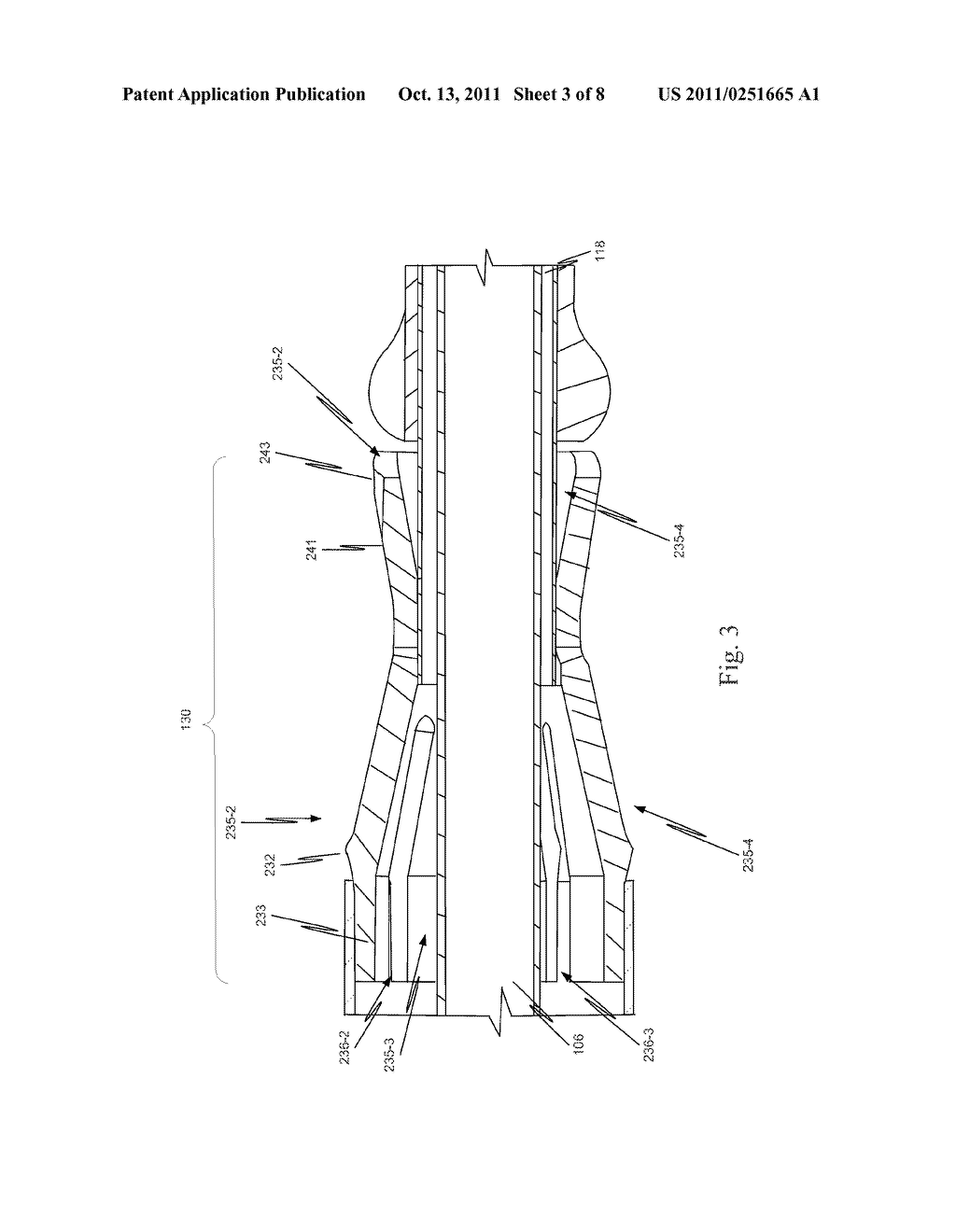 Delivery System Ejection Component and Method - diagram, schematic, and image 04