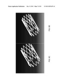 EXPANDABLE STENT THAT COLLAPSES INTO A NON-CONVEX SHAPE AND EXPANDS INTO     AN EXPANDED, CONVEX SHAPE diagram and image