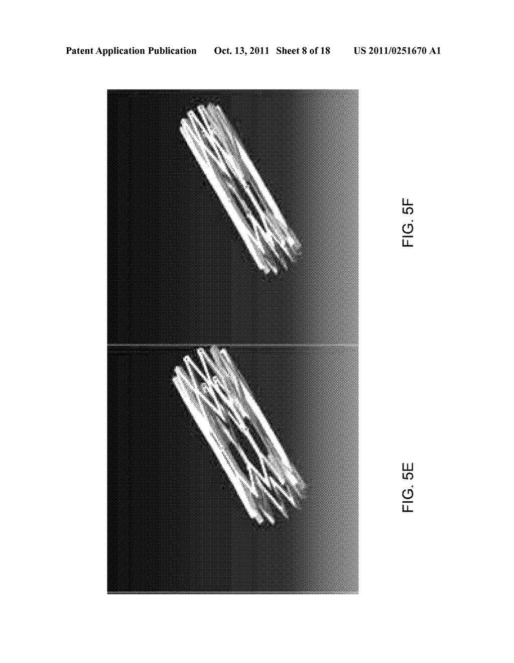 EXPANDABLE STENT THAT COLLAPSES INTO A NON-CONVEX SHAPE AND EXPANDS INTO     AN EXPANDED, CONVEX SHAPE - diagram, schematic, and image 09